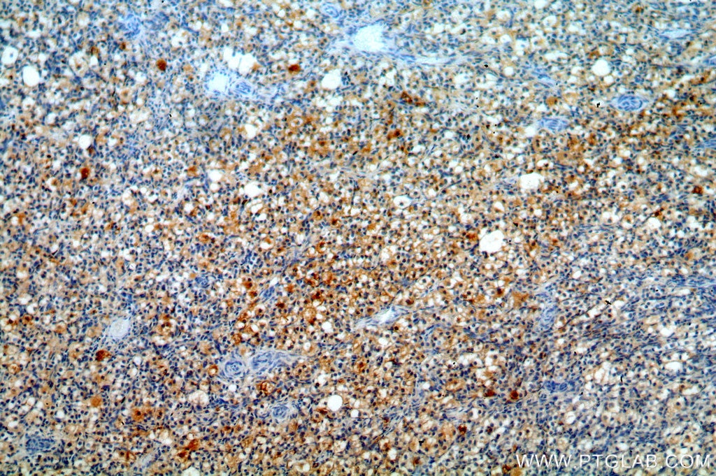 Immunohistochemistry (IHC) staining of human ovary tissue using MPRIP Polyclonal antibody (20040-1-AP)
