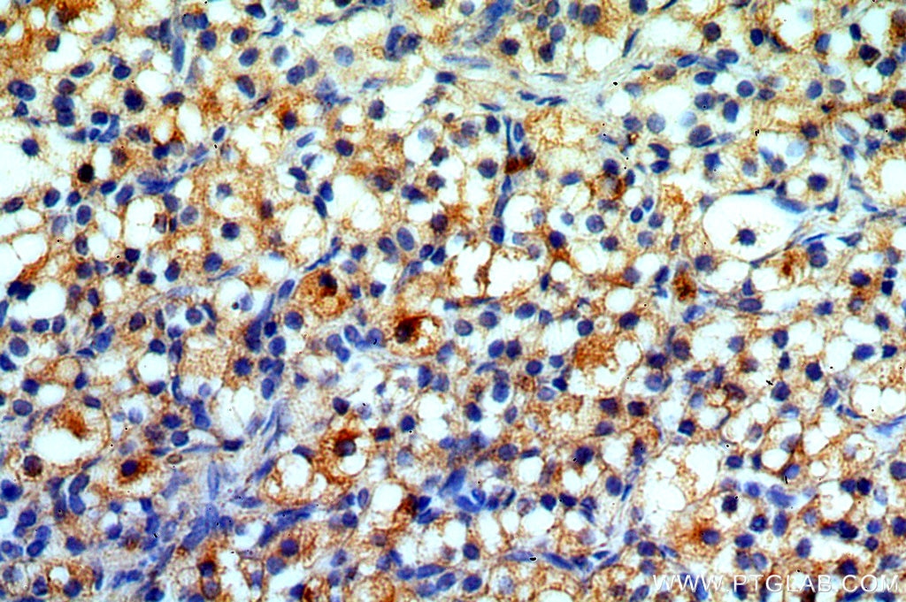 Immunohistochemistry (IHC) staining of human ovary tissue using MPRIP Polyclonal antibody (20040-1-AP)