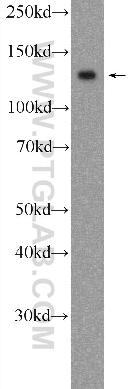 Western Blot (WB) analysis of A2780 cells using MPRIP Polyclonal antibody (20040-1-AP)