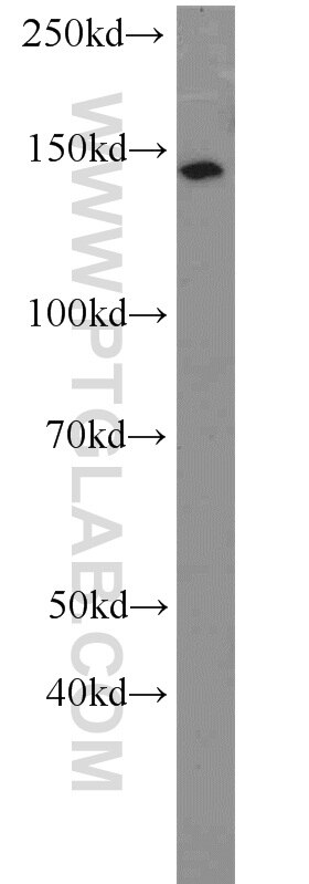 Western Blot (WB) analysis of SH-SY5Y cells using MPRIP Polyclonal antibody (20040-1-AP)