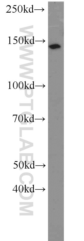 Western Blot (WB) analysis of SH-SY5Y cells using MPRIP Polyclonal antibody (20040-1-AP)