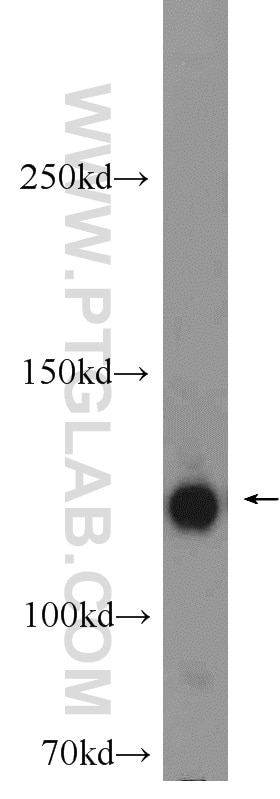Western Blot (WB) analysis of SKOV-3 cells using MPRIP Polyclonal antibody (20040-1-AP)