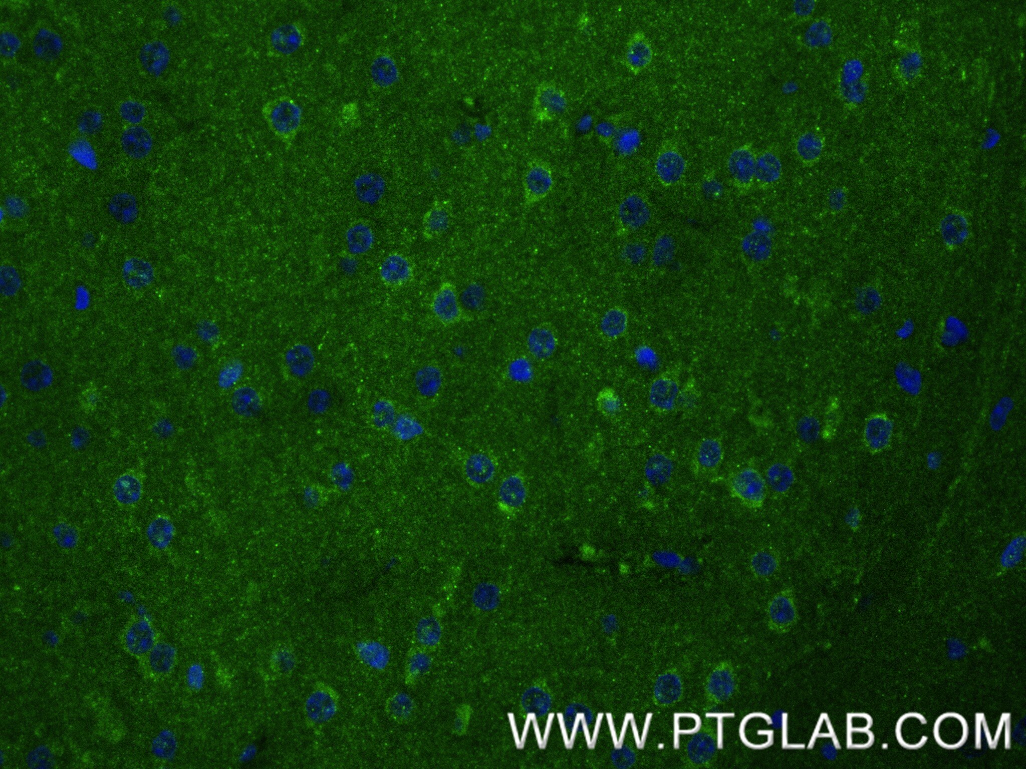 Immunofluorescence (IF) / fluorescent staining of mouse brain tissue using MPRIP Recombinant antibody (86033-1-RR)