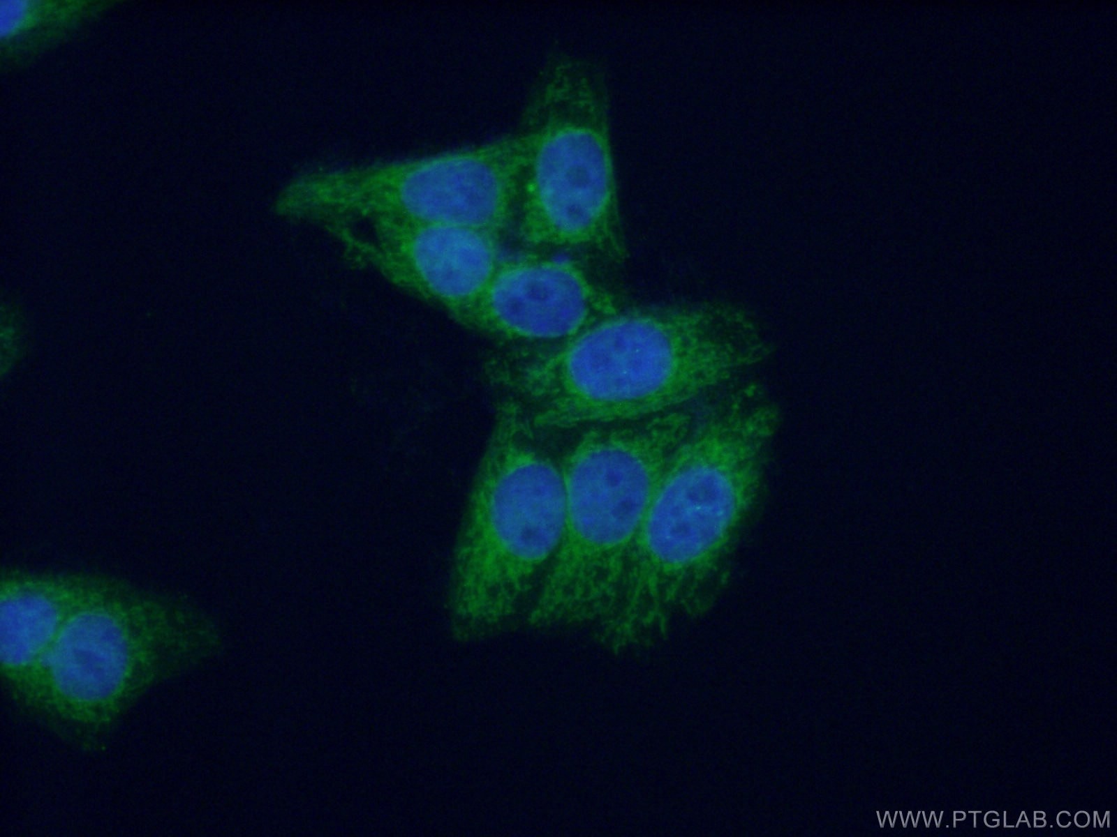Immunofluorescence (IF) / fluorescent staining of HepG2 cells using MPV17 Polyclonal antibody (10310-1-AP)