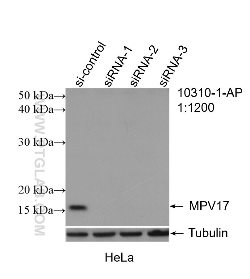 Western Blot (WB) analysis of HeLa cells using MPV17 Polyclonal antibody (10310-1-AP)