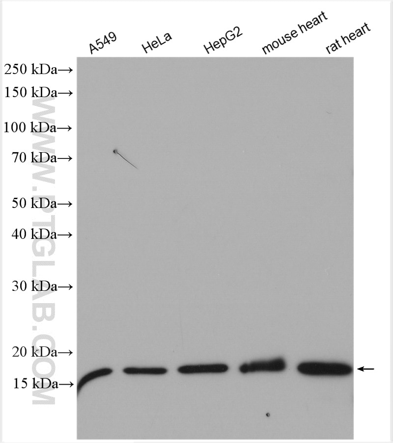 Western Blot (WB) analysis of various lysates using MPV17 Polyclonal antibody (10310-1-AP)