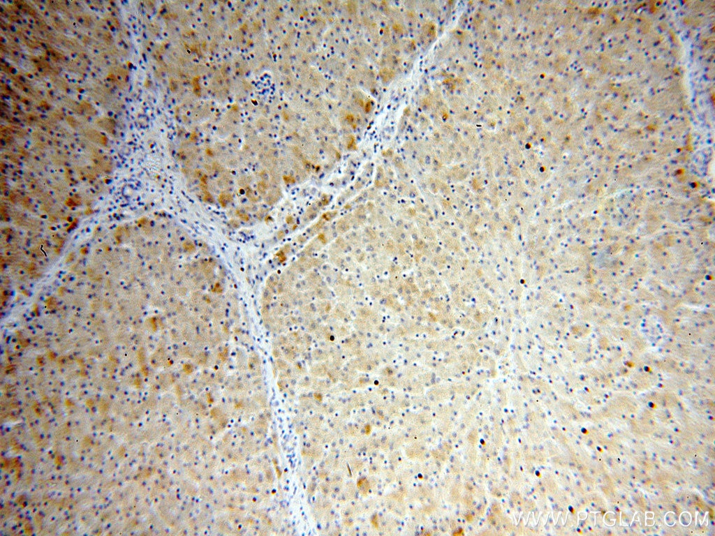 Immunohistochemistry (IHC) staining of human liver tissue using MPV17 Monoclonal antibody (60103-1-Ig)