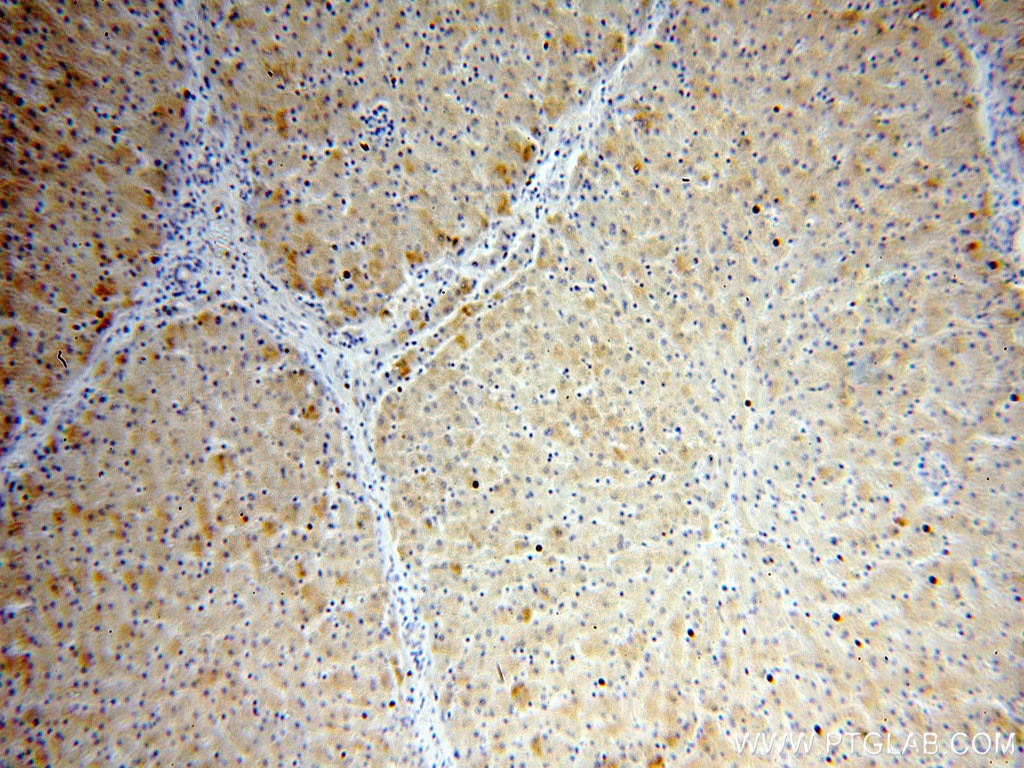 IHC staining of human liver using 60103-1-Ig