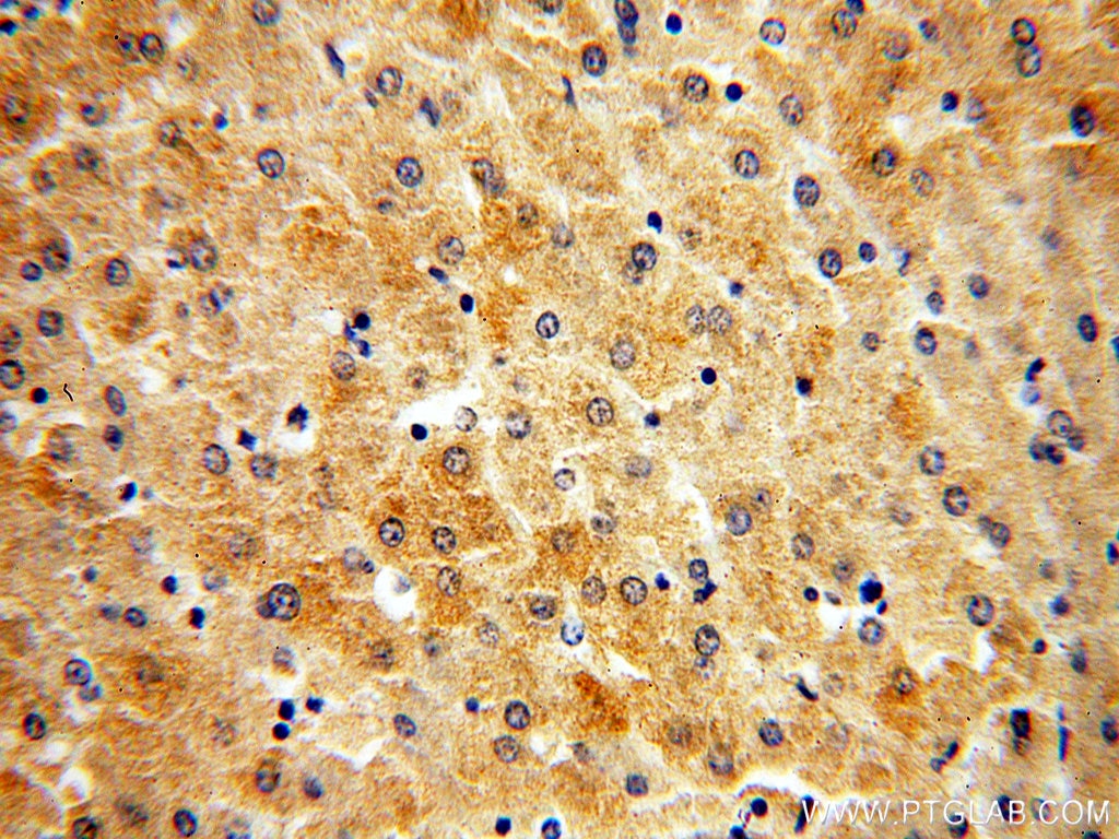 Immunohistochemistry (IHC) staining of human liver tissue using MPV17 Monoclonal antibody (60103-1-Ig)