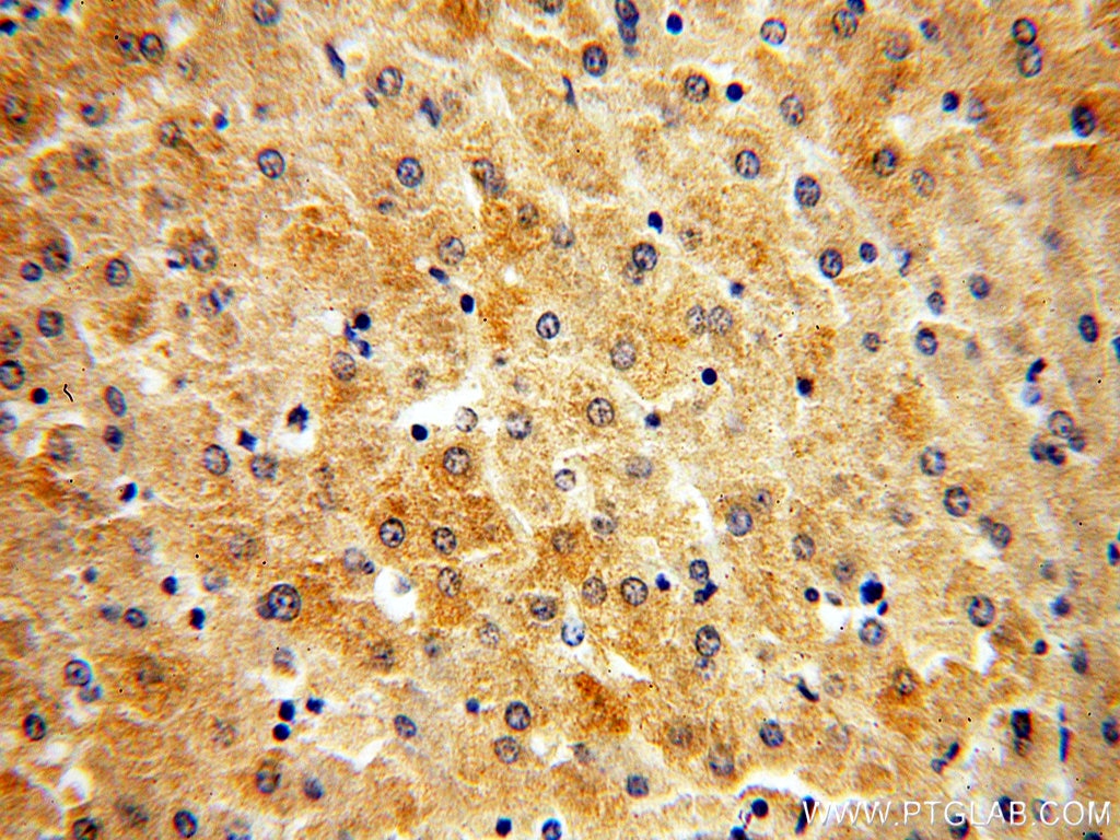 Immunohistochemistry (IHC) staining of human liver tissue using MPV17 Monoclonal antibody (60103-1-Ig)