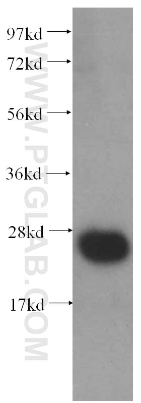 Western Blot (WB) analysis of human heart tissue using MPV17 Monoclonal antibody (60103-1-Ig)