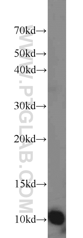 Western Blot (WB) analysis of HEK-293 cells using MPV17L Polyclonal antibody (17884-1-AP)