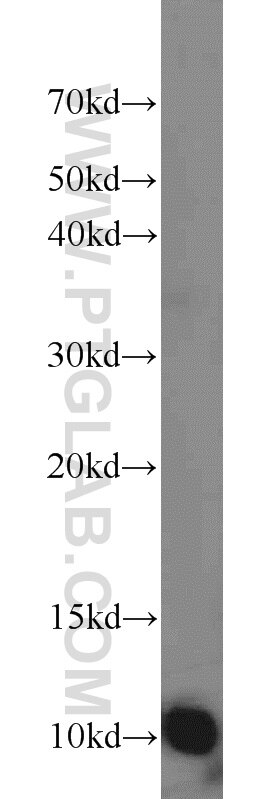 WB analysis of HEK-293 using 17884-1-AP