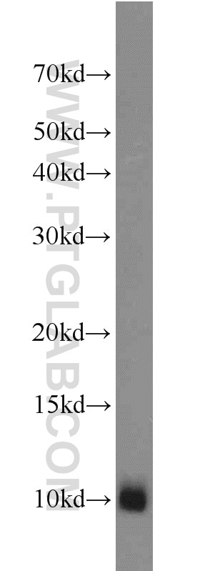 Western Blot (WB) analysis of mouse kidney tissue using MPV17L Polyclonal antibody (17884-1-AP)