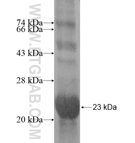 MPV17L fusion protein Ag11935 SDS-PAGE