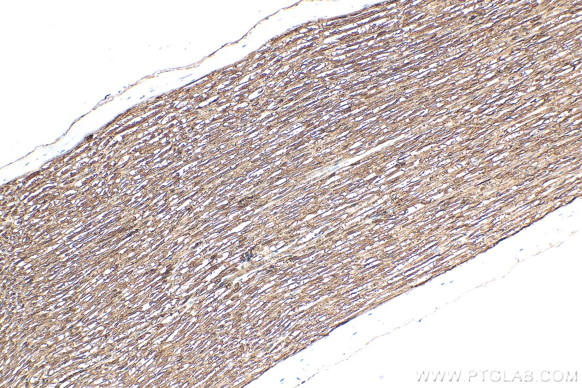 Immunohistochemistry (IHC) staining of rat Ischiadic nerve tissue using MPZ / P0 Polyclonal antibody (10572-1-AP)