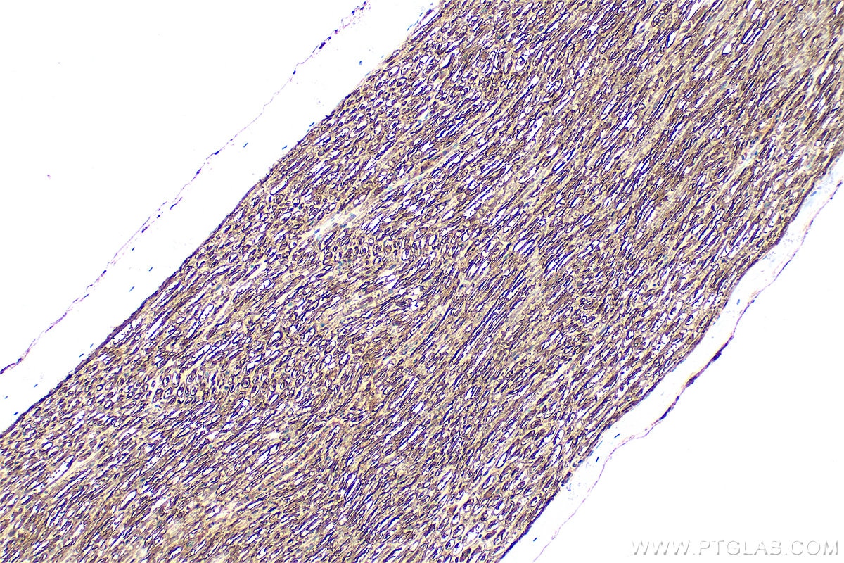 Immunohistochemistry (IHC) staining of rat Ischiadic nerve tissue using MPZ / P0 Polyclonal antibody (10572-1-AP)