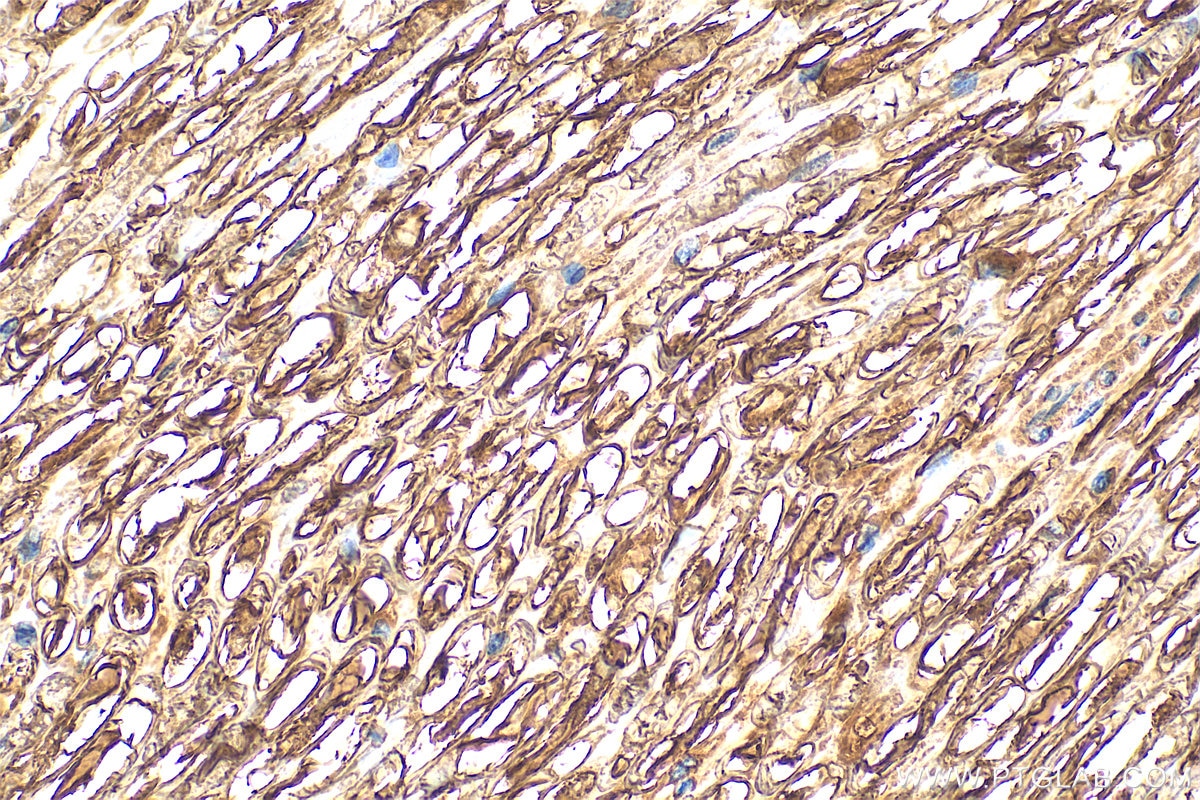 Immunohistochemistry (IHC) staining of rat Ischiadic nerve tissue using MPZ / P0 Polyclonal antibody (10572-1-AP)