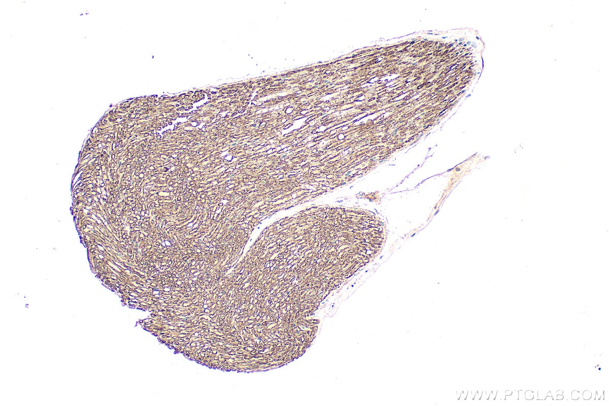 IHC staining of mouse Ischiadic nerve using 10572-1-AP Immunohistochemistry (IHC) staining of mouse Ischiadic nerve tissue using MPZ / P0 Polyclonal antibody (10572-1-AP)
