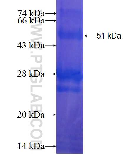 MPZ,P0 fusion protein Ag0848 SDS-PAGE