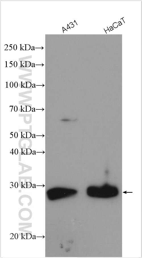 Western Blot (WB) analysis of various lysates using MPZL2 Polyclonal antibody (11787-1-AP)