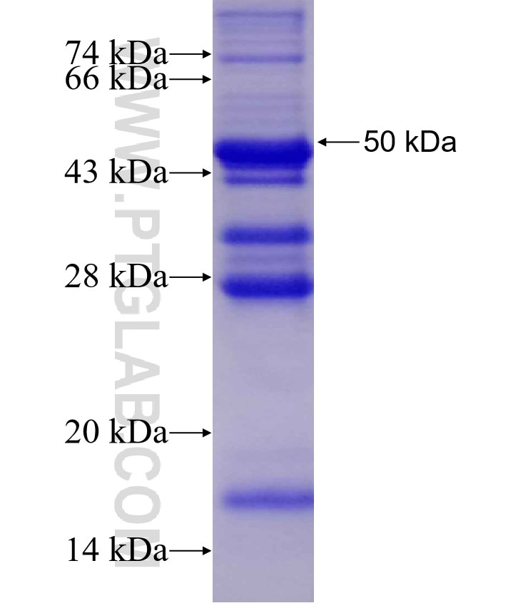 MPZL2 fusion protein Ag2419 SDS-PAGE