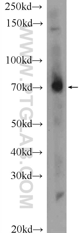 Western Blot (WB) analysis of mouse liver tissue using MPZL3 Polyclonal antibody (25513-1-AP)