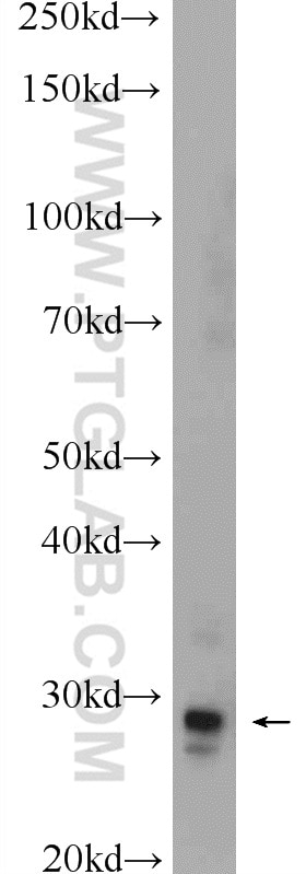 Western Blot (WB) analysis of mouse brain tissue using MPZL3 Polyclonal antibody (25513-1-AP)