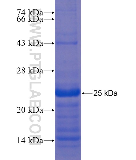 MPZL3 fusion protein Ag21905 SDS-PAGE