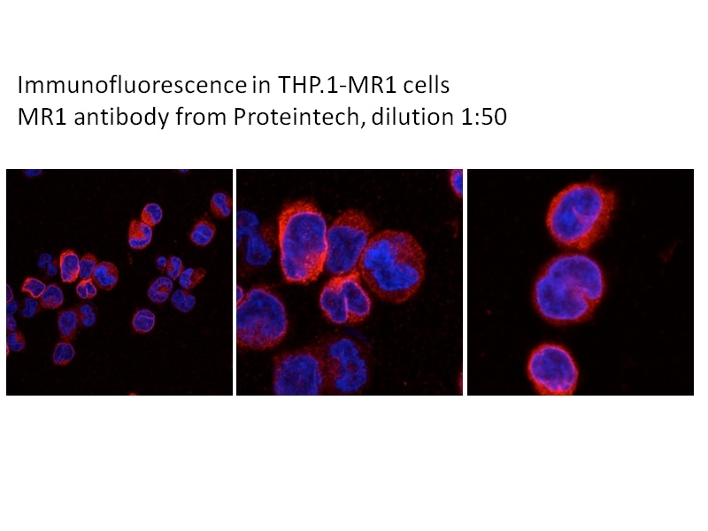 Immunofluorescence (IF) / fluorescent staining of THP-1 cells using MR1 Polyclonal antibody (13260-1-AP)