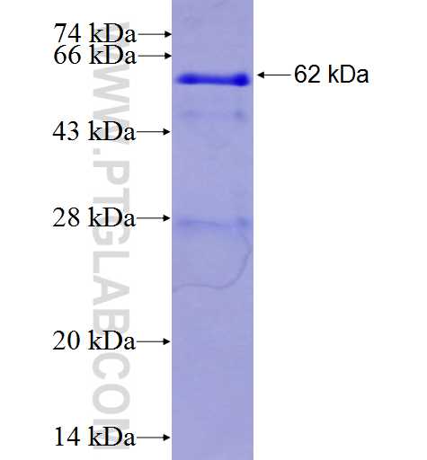 MR1 fusion protein Ag3849 SDS-PAGE