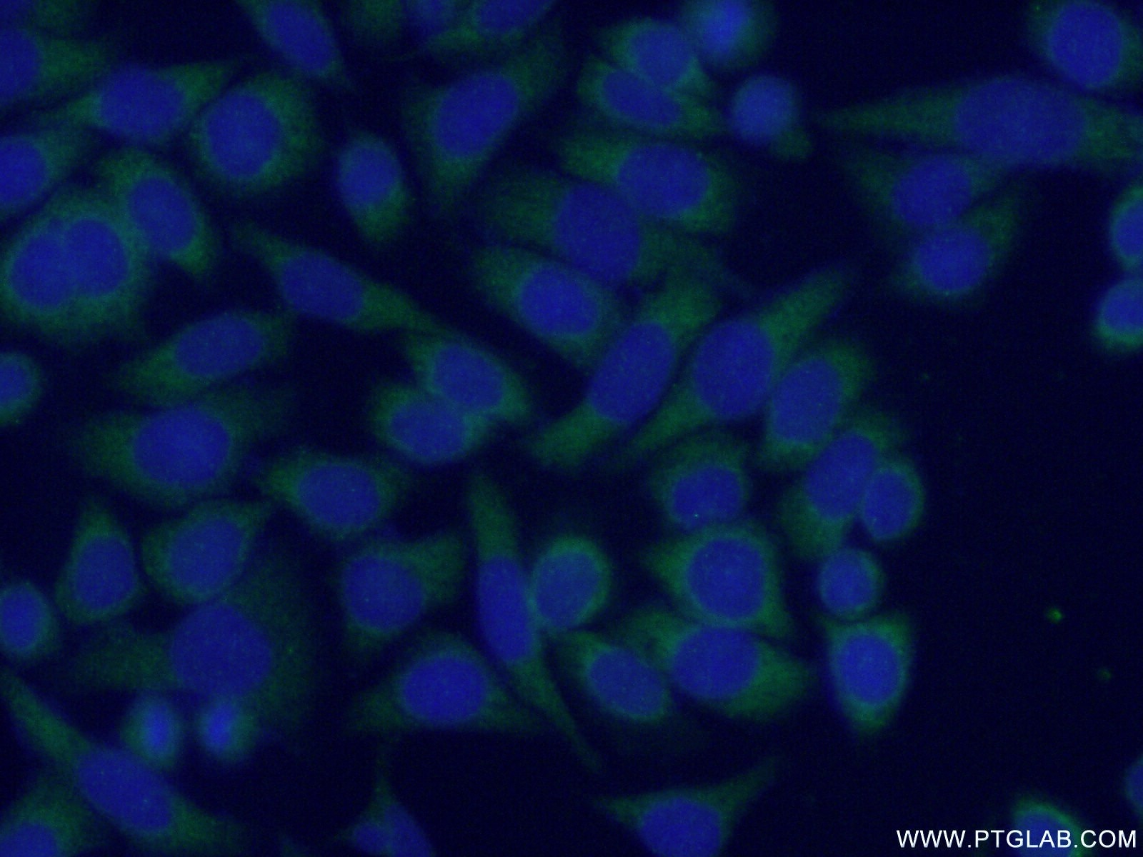 Immunofluorescence (IF) / fluorescent staining of HeLa cells using MRAP Polyclonal antibody (19512-1-AP)