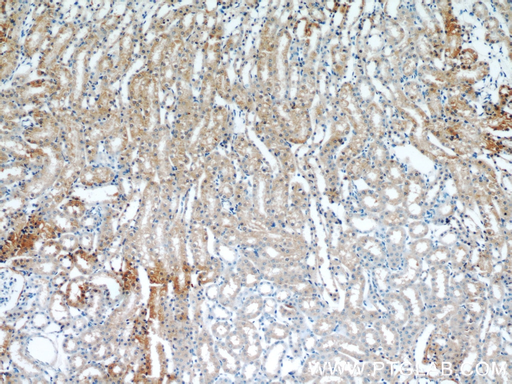 Immunohistochemistry (IHC) staining of mouse kidney tissue using MRAP Polyclonal antibody (19512-1-AP)