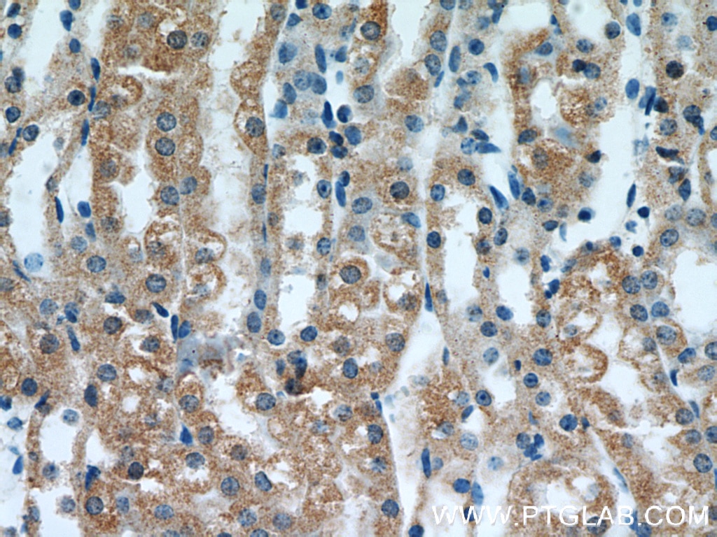 Immunohistochemistry (IHC) staining of mouse kidney tissue using MRAP Polyclonal antibody (19512-1-AP)