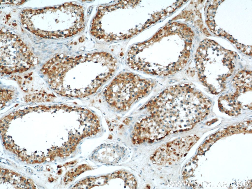 Immunohistochemistry (IHC) staining of human testis tissue using MRAP Polyclonal antibody (19512-1-AP)