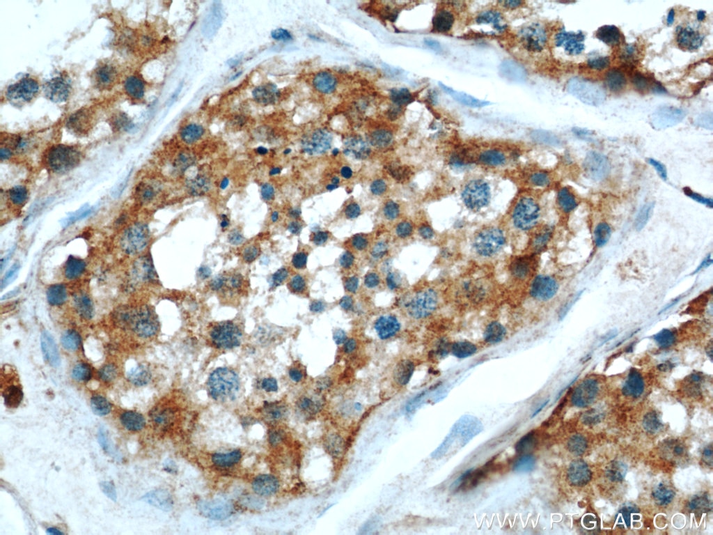 Immunohistochemistry (IHC) staining of human testis tissue using MRAP Polyclonal antibody (19512-1-AP)