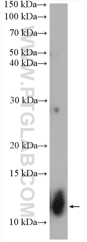 Western Blot (WB) analysis of mouse kidney tissue using MRAP Polyclonal antibody (19512-1-AP)