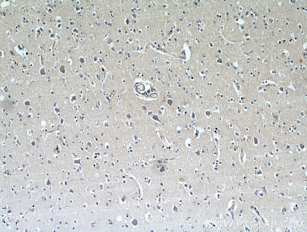 IHC staining of human brain using 17259-1-AP