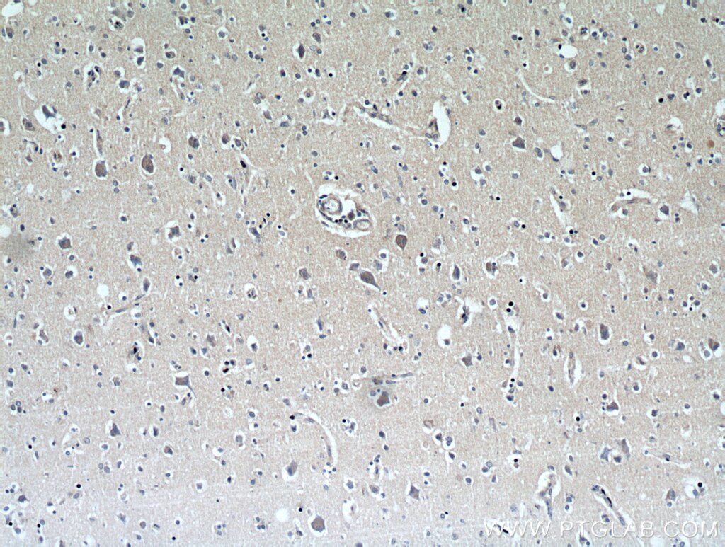 Immunohistochemistry (IHC) staining of human brain tissue using MRAP2 Polyclonal antibody (17259-1-AP)