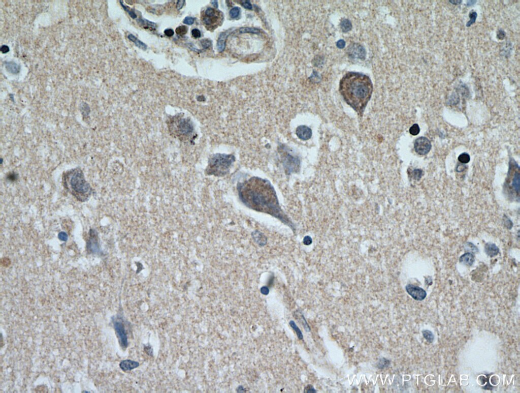 IHC staining of human brain using 17259-1-AP