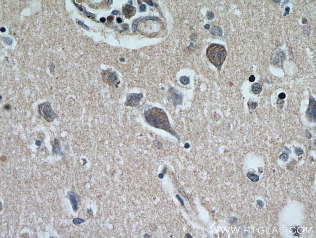 Immunohistochemistry (IHC) staining of human brain tissue using MRAP2 Polyclonal antibody (17259-1-AP)