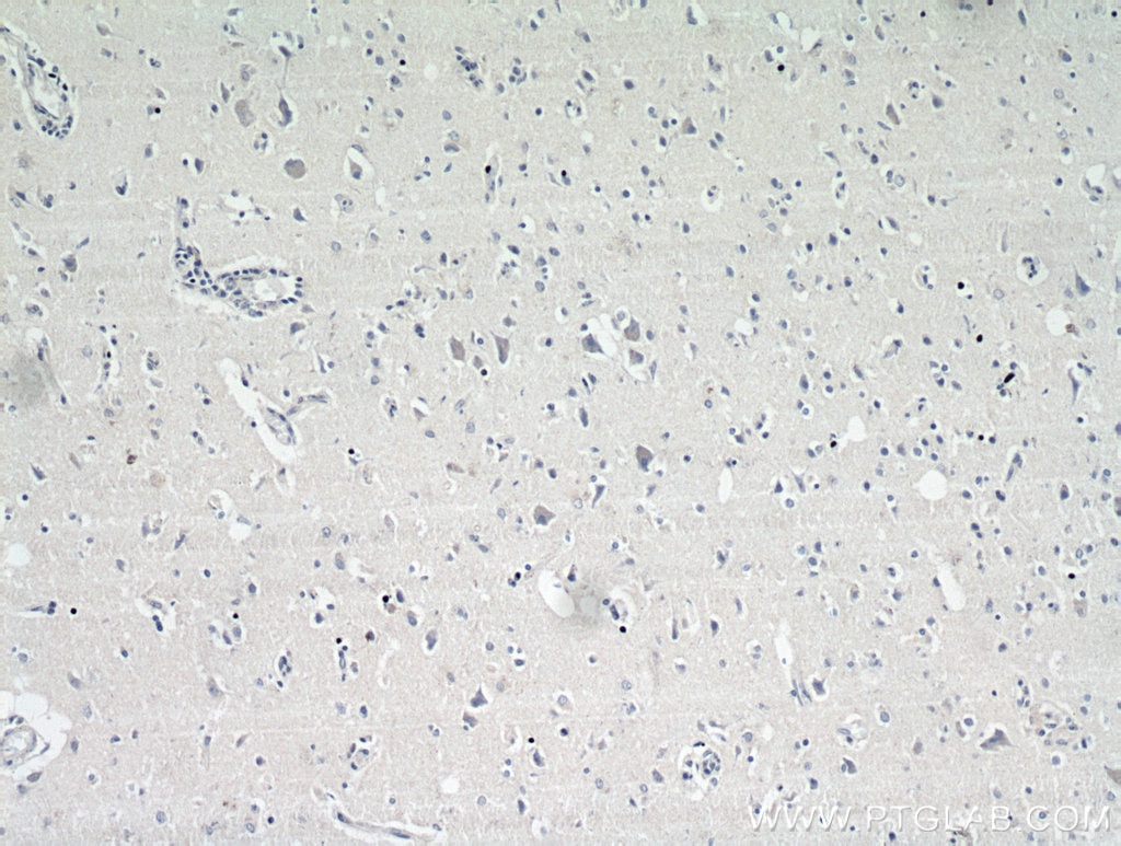 Immunohistochemistry (IHC) staining of human brain tissue using MRAP2 Polyclonal antibody (17259-1-AP)