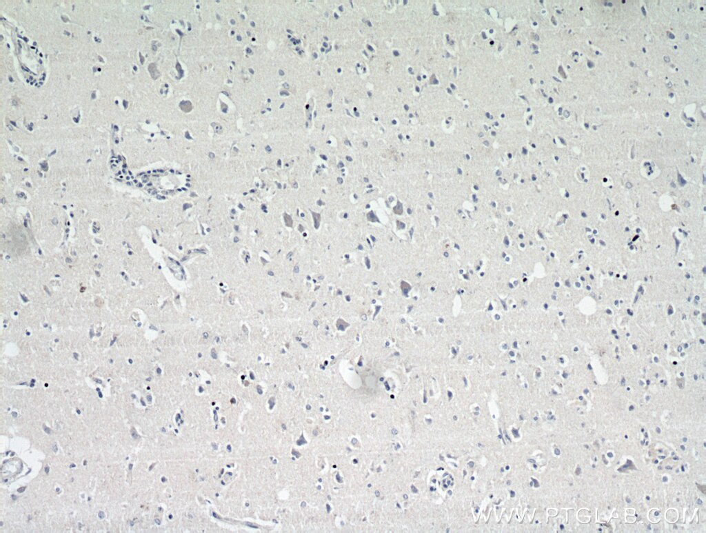 Immunohistochemistry (IHC) staining of human brain tissue using MRAP2 Polyclonal antibody (17259-1-AP)