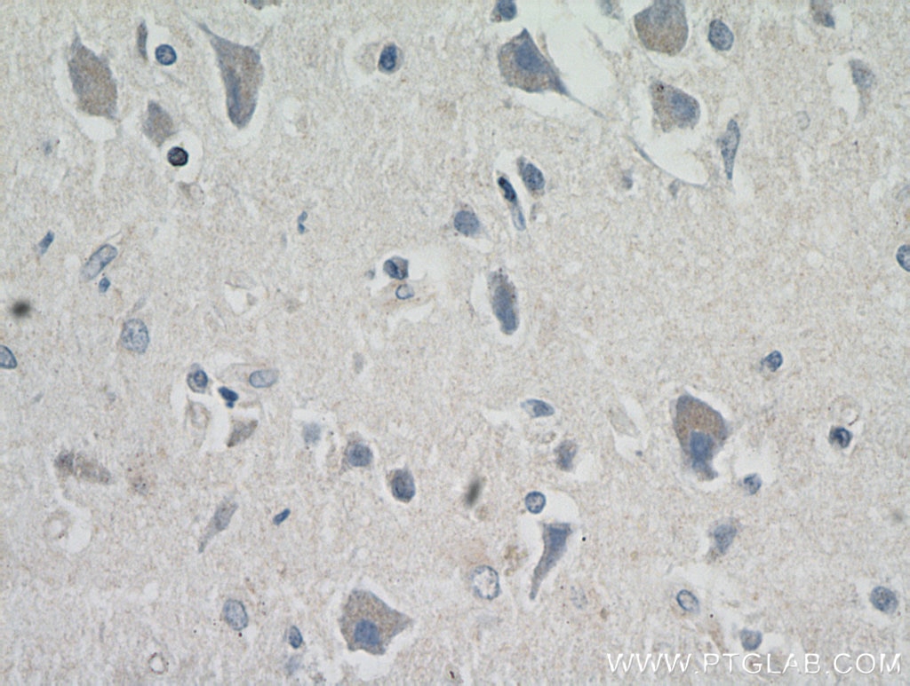 Immunohistochemistry (IHC) staining of human brain tissue using MRAP2 Polyclonal antibody (17259-1-AP)