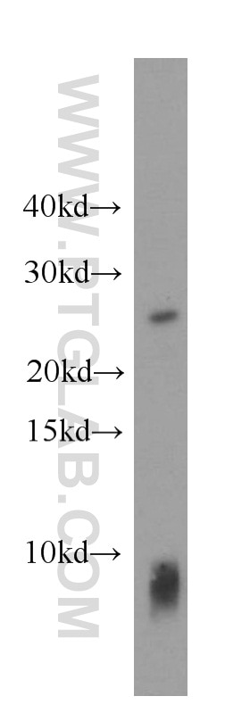 Western Blot (WB) analysis of human brain tissue using MRAS Polyclonal antibody (14213-1-AP)