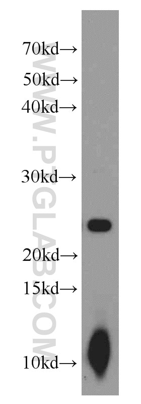 MRAS Polyclonal antibody