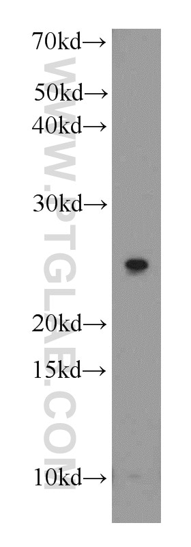 Western Blot (WB) analysis of mouse lung tissue using MRAS Polyclonal antibody (14213-1-AP)