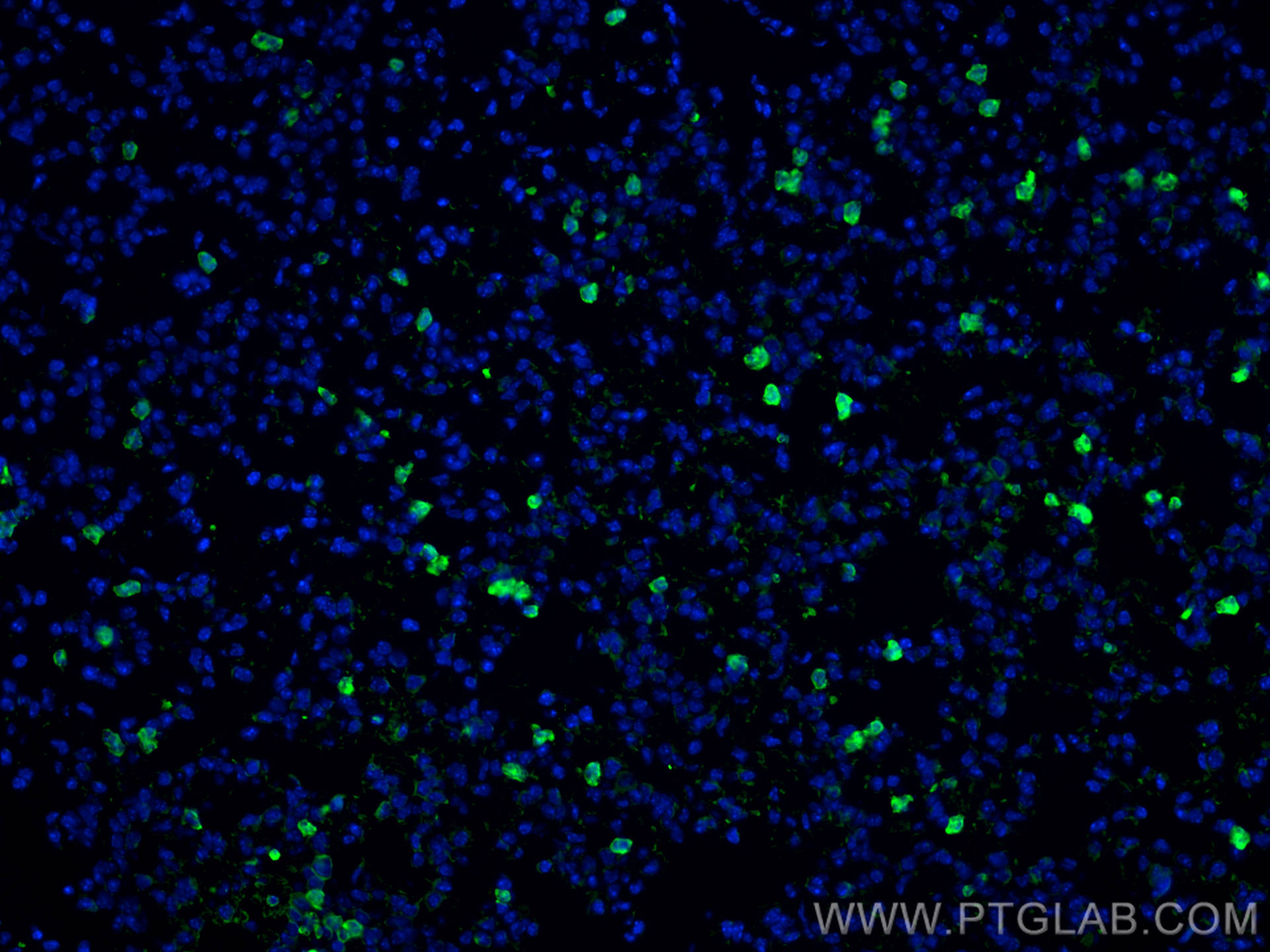 Immunofluorescence (IF) / fluorescent staining of mouse lung tissue using CD206 Polyclonal antibody (18704-1-AP)
