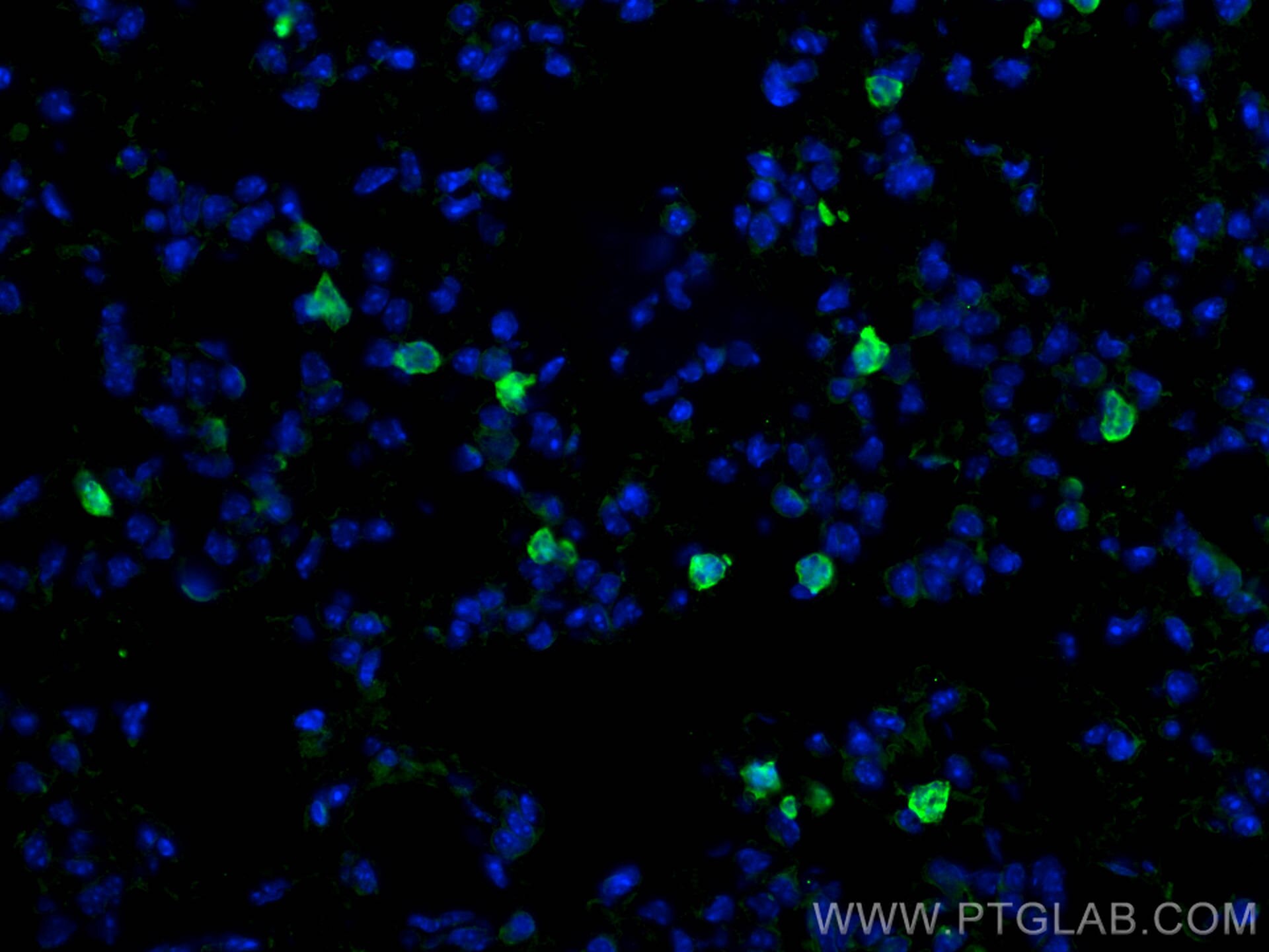 Immunofluorescence (IF) / fluorescent staining of mouse lung tissue using CD206 Polyclonal antibody (18704-1-AP)