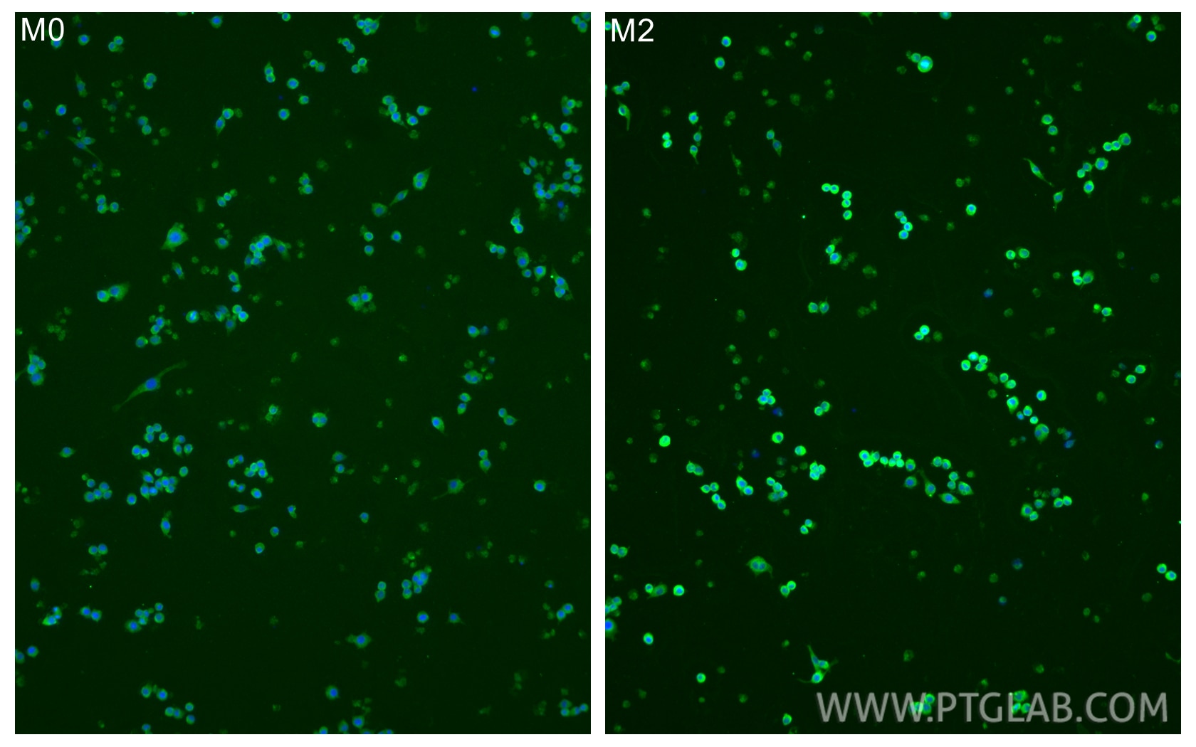 Immunofluorescent analysis of (4% PFA) fixed RAW 264.7 cells using CD206 antibody (18704-1-AP) at dilution of 1:200 and CoraLite®488-Conjugated Goat Anti-Rabbit IgG(H+L) (SA00013-2). M0: RAW 264.7 cells were treated with PBS. M2: RAW 264.7 cells were treated with 10 ng/mL IL-4 for 24h. Immunofluorescence (IF) / fluorescent staining of RAW 264.7 cells using CD206 Polyclonal antibody (18704-1-AP)